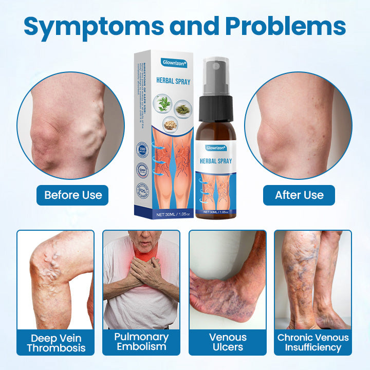 Glowrizon® VeinGuard Herbal Spray – Clinically Proven to Diminish Varicose Veins in Just 7 Days