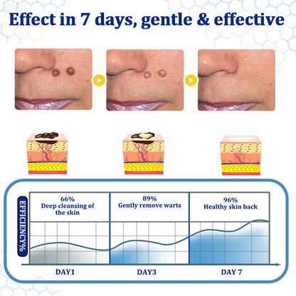 👩‍⚕️LOVILDS™ BeeDerm RX Cream, Painless, easy and gentle fix for warts, skin tags, lumps, infections, cysts and scars🎁