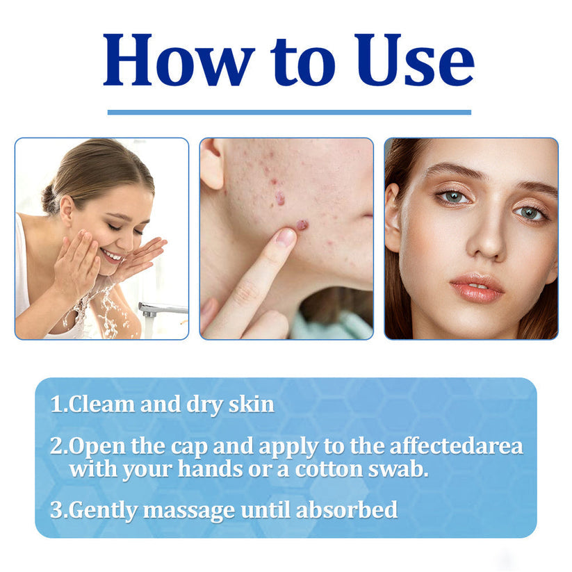 👩‍⚕️LOVILDS™ BeeDerm RX Cream, Painless, easy and gentle fix for warts, skin tags, lumps, infections, cysts and scars🎁