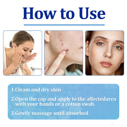 👩‍⚕️LOVILDS™ BeeDerm RX Cream, Painless, easy and gentle fix for warts, skin tags, lumps, infections, cysts and scars🎁