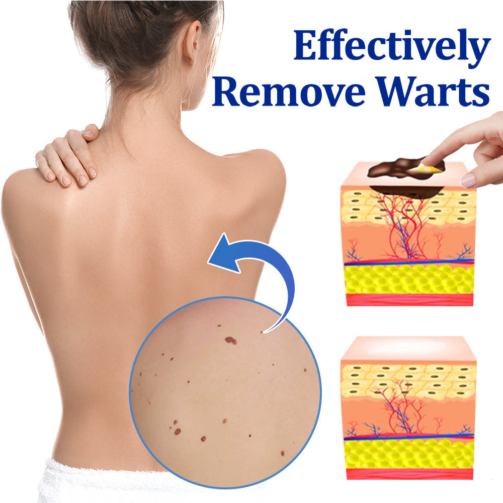 👩‍⚕️LOVILDS™ BeeDerm RX Cream, Painless, easy and gentle fix for warts, skin tags, lumps, infections, cysts and scars🎁