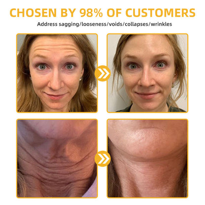 💐💞Lovilds™ BeeLift Anti-Aging Firming Cream,Address Crepe & Sagging(🔥74% Off for a Limited Time!)