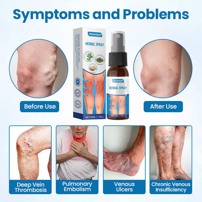 Glowrizon® VeinGuard Herbal Spray – Clinically Proven to Diminish Varicose Veins in Just 7 Days