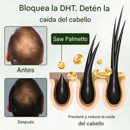 QIAWI Follicure BioGrow Spray Restaurador Capilar (Reactiva tus raíces. Regenera tu cabello de forma natural. ✨ Recuperación del cabello clínicamente comprobada en 4 semanas ✨)